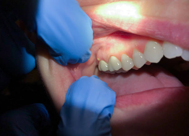 Best Emergency Treatment for Toothache in Wainaku, HI